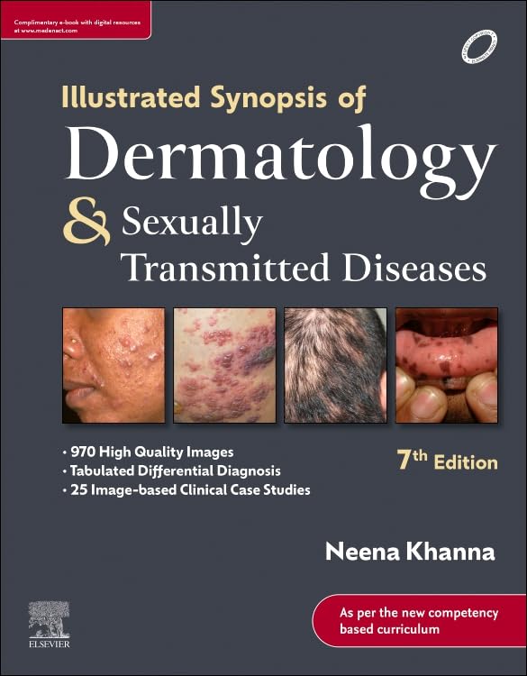 Illustrated Synopsis of Dermatology and Sexually Transmitted Diseases by Neena Khanna